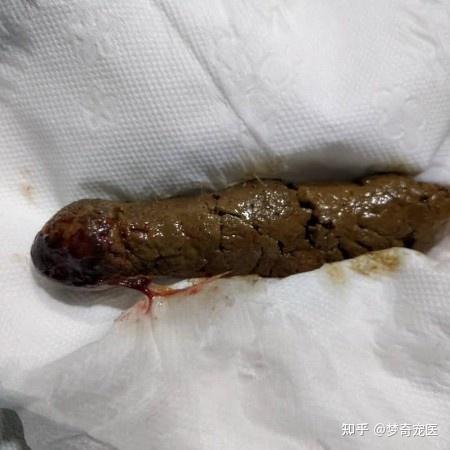 大便出血是怎么回事_出血大便回事是怎么回事_出血大便回事是痔疮吗
