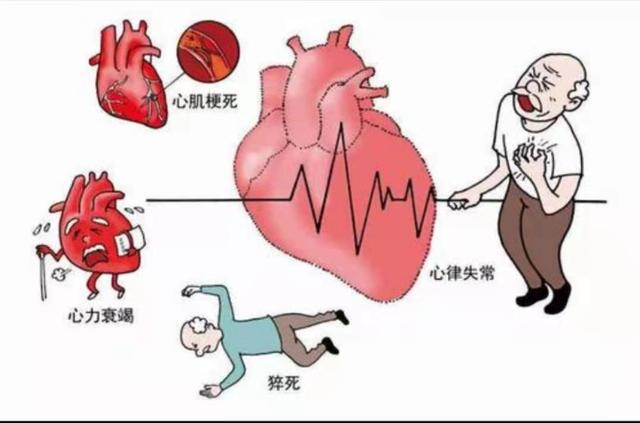 老年冠心病的护理_冠心病老人护理_老年冠心病的家庭护理