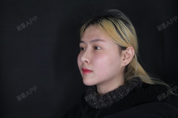 肛瘘手术多长时间长好_手术肛瘘时间多长_肛瘘手术时间