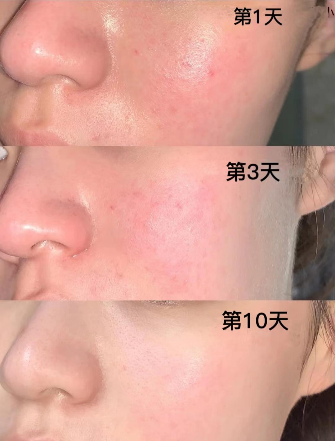 教程使用情况分析_rmprepusb使用教程_教程使用昆恩法印