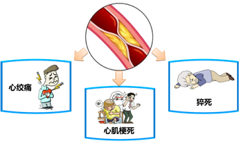 冠心病的病例如何书写_冠心病的病例_冠心病诊断病历书写顺序